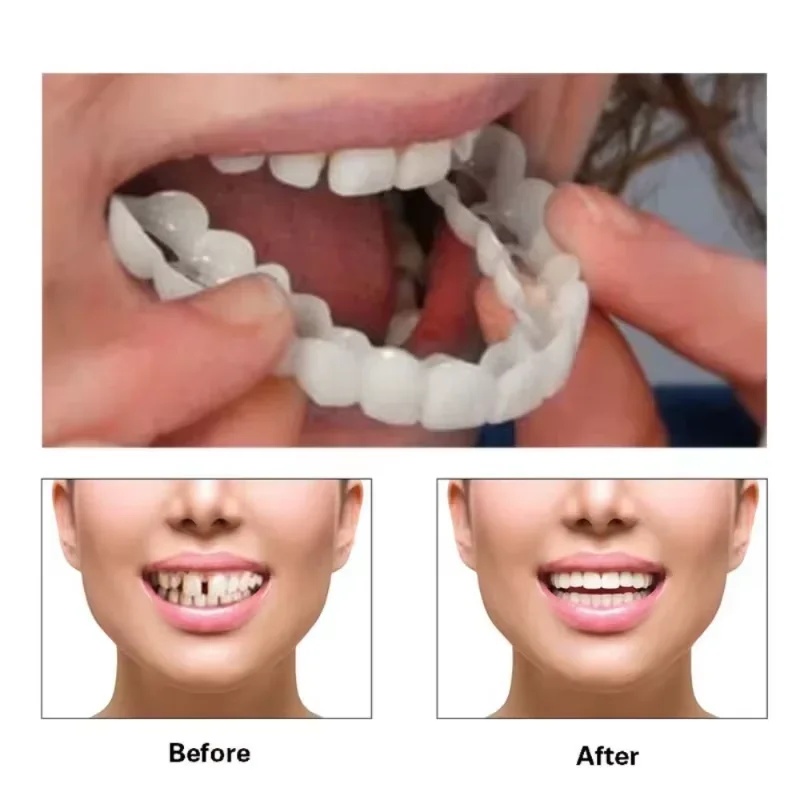 Snap-on Veneer Teeth Kit Adjus - Teeth Whitening Kit ulasan dan harga